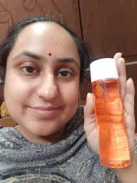 HELP during my pregnancy i developed some pretty bad stretch marks