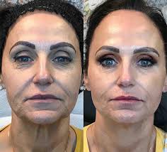 NovaThreads Temecula