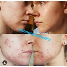 Jenise Rodriguez (@sanaraesthetics) • Instagram photos and videos