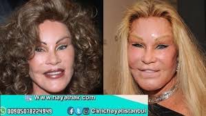 عمليات التجميل الفاشلة مركز الحياة الطبي