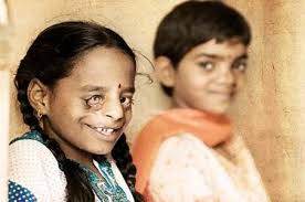 Cleft-Kinder-Hilfe • Professor Hermann Sailer Stiftung