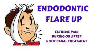 Root canal treatment or root canal therapy, is the name given to a procedure that involves removing decay and infection that exists inside centre and an abscess is an inflamed area in which pus collects and can cause swelling of the tissues around the tooth. Endodontic Flare Up Management Extreme Pain Swelling During After Root Canal Treatment Rct Youtube