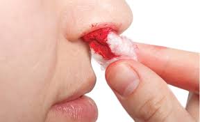 Maybe you would like to learn more about one of these? Los Primeros Sintomas De Leucemia Diario Quienopina Com Noticias De Honduras Y El Mundo