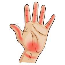 Ce trouble se caractérise par des picotements, engourdissements et fourmillements au niveau d'un membre, généralement aux extrémités. Vos Mains Peuvent En Dire Beaucoup Sur Votre Sante