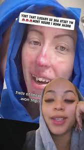 It’s been years 😥 abi.burleigh #dentalhygiene #dentalhygienist  #periodontaldisease #mouthdiseasebrushing my teeth for the first time in  years #tiktokuni #fypシ゚viral #foryoupag #fypツ