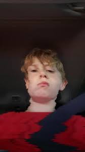 Becker Minnick Death from Head Cancer