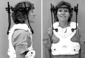 How Are Spinal Cord Injuries Treated University Of Iowa Hospitals Clinics