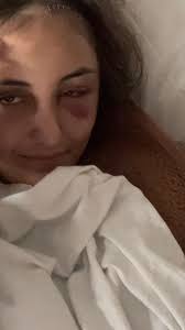 ✨ A true miracle ✨, By the hands of my amazing doctor and the incredible  team at Cleveland Clinic, a miracle was done., Only one month after her  brain lobectomy, she’s seizure-free — after having them ...