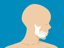 I did my surgery in may 2019 @ hkl (dr. Facial Feminization Surgery Male To Female Recovery Time Cost