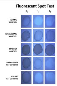 Image result for G6PD Deficiency Detection