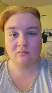 Just found out a few days ago that i was diagnosed with Bell's palsy but  the weird thing is is that a month ago I started having symptoms my ear got  really sensitive and so I want to see the doctor ...