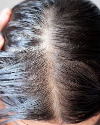 Realself verified doctors complete our multistep verification process and meet rigorous requirements to become our most trusted plastic surgeons and cosmetic procedure providers. 12 Signs Of Hair Loss To Bring Up To Your Dermatologist Gma