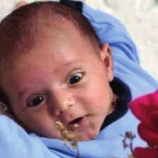 Mohammed was the chief pathologist at the Islamic University of Gaza and  al-Shifa Hospital. He did research