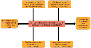 Image result for Connective Tissue Disorder