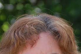 So, right here we brought the most important. How To Fix Gray Hair Roots With Photoshop Learn Pro Photography