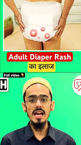 Image result for diaper dermatitis adult -children -infant -baby