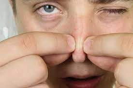 Jika kalian ingin menghilangkan blackhead gunakanlah gentle cleanser dengan cotton sheet atau girls, jika kalian memilik jerawat atau blackhead cara paling mudah adalah melakukan ekstraksi. 5 Cara Mudah Menghilangkan Blackhead Untuk Cowok