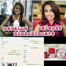 Ibu putih nina skincare kkm. Nina Skin Care Ibu Putih Laser Serum Shopee Malaysia