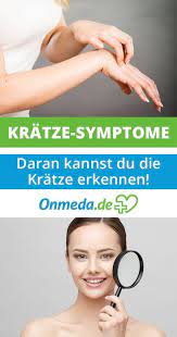 kratze erkennen und behandeln onmeda de kratze krankheit gesundheit
