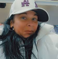 Lipo 360 with J plasma results and comparison to tummy tuck