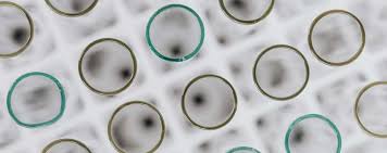 These forms may have more treatment options available compared to rarer types of mesothelioma. Peritoneal Mesothelioma At The Focus Of An Immunotherapy Anti Angiogenesis Study Mesothelioma Applied Research Foundation