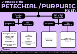Purpura (/ ˈpɜːrpjʊərə /) is a condition of red or purple discolored spots on the skin that do not blanch on applying pressure. Algorithm For Diagnosis Of The Petechial Purpuric Grepmed