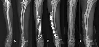Kemik Kirigi Nasil Hizli Iyilesir Kirik Tedavisinde Yeni Yontemler