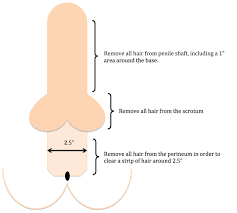 Electrolysis is the only hair removal method that permanently removes the hair. Genital Hair Clearing Preparing For Your Gender Reassignment Surgery 2pass Clinic