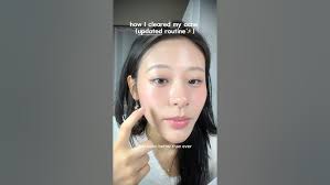 *not sponsored* how I cleared my acne (updated routine)✨