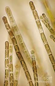 Image result for Alinula sp.