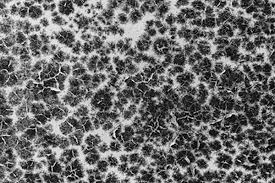 How long does it take for toxic black mold to grow. What Is Black Mold And Can It Actually Kill You Rock Environmental