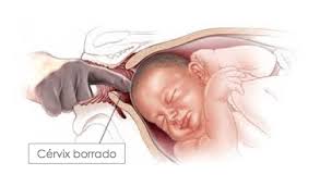 Le col de l'utérus se dilate spontanément lorsque le bébé est enfin prêt pour sortir Qu Est Ce Que L Effacement Du Col De L Uterus Etre Parents