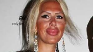 HANDE ACAR SİLİKONU ABARTTI