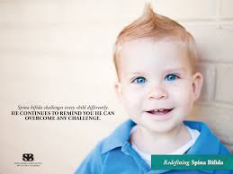 2012 Spina Bifida awareness campaign » Amanda Kern