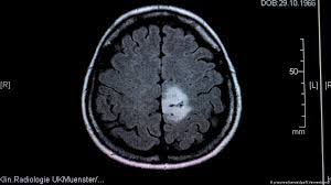 But a new study has revealed that it's how you talk to your child that really matters for their brain growth. Brain Tumors In Children When All That Matters Is Now Science In Depth Reporting On Science And Technology Dw 08 06 2020
