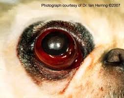 Image result for Proptosis