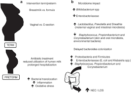 Factors Influencing Gastrointestinal Tract And Microbiota Immune Interaction In Preterm Infants Pediatric Research