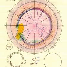 Pdf Retinal Drawing A Lost Art Of Medicine