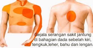 Yuk kita simak penyebab sakit kepala sebelah kiri namun, tidak setiap sakit kepala sebelah kiri dapat dikatakan sebagai migrain ataupun karena lelah. Khairul Hafidz On Twitter Sakit Dada Kiri Rasa Menekan Dihempap Boleh Menjalar Ke Tangan Kiri Tengkuk Berpeluh Sesak Nafas Berdebar Dsb Https T Co Yvtq9avafx