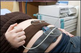 Image result for Non-Stress Test