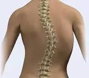 Image result for icd 10 code for s-shaped scoliosis of the thoracolumbar spine