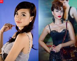 Mới đây, nữ blogger công khai hình ảnh mới phẫu thuật mũi. Nhin áº£nh Qua Khá»© Gia NhÆ° Thu Thá»§y Va Nhá»¯ng Má»¹ Nhan Nay Ä'á»«ng Pttm