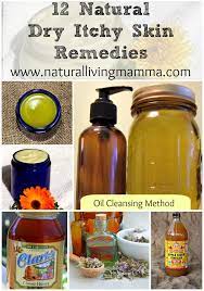 12 Natural Dry Itchy Skin Remedies Natural Living Mamma Dry Itchy Skin Remedies Dry Itchy Skin Skin Remedies