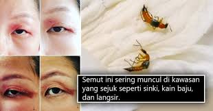 Semut charlie berasal dari kumpulan kumbang (staphylinidae). Serangga Kecil Dengan Bisa Menyakitkan Pada Kulit Juga Sangat Berbahaya Orang Ramai Dinasihatkan Berwaspada Apabila Terserempak Semut Charlie Era Baru