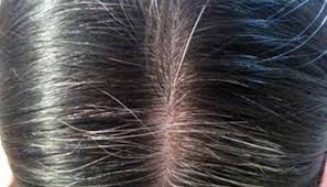 Si chiama silver glow ed è firmato wella professionals. Capelli Bianchi Tutte Le Alternative Alla Tinta Chimica