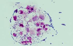 Image result for Group D Streptococcus