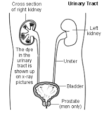 Image result for Intravenous Pyelogram