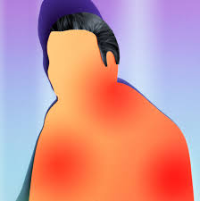 The development of amoxicillin rash without any additional symptoms may, however, indicate that the person does hives appear as raised, red bumps that can come and go and change location and are usually very itchy. He Was Unbearably Itchy But The Problem Wasn T In His Skin The New York Times