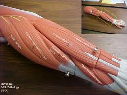 The extensor digiti minimi (also extensor digiti minimi muscle, extensor digiti quinti proprius, latin: Steven Lee M S Pathology Ftcc Ppt Video Online Download