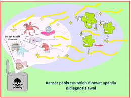 Rangsangan dapat dikesan oleh lidah adalah dengan adanya reseptor penerima rangsang yang berupa kuncup pengecap yang berada di dalam papilla lidah. Simptom Pengesanan Dan Rawatan Untuk Kanser Pankreas Majalahsains